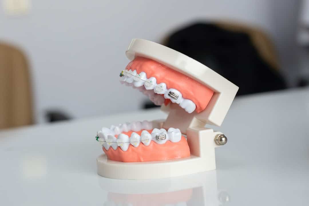 5 Tips on Caring for Metal Braces