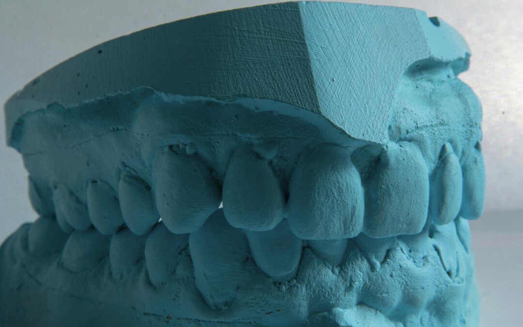 can you eat with invisalign
