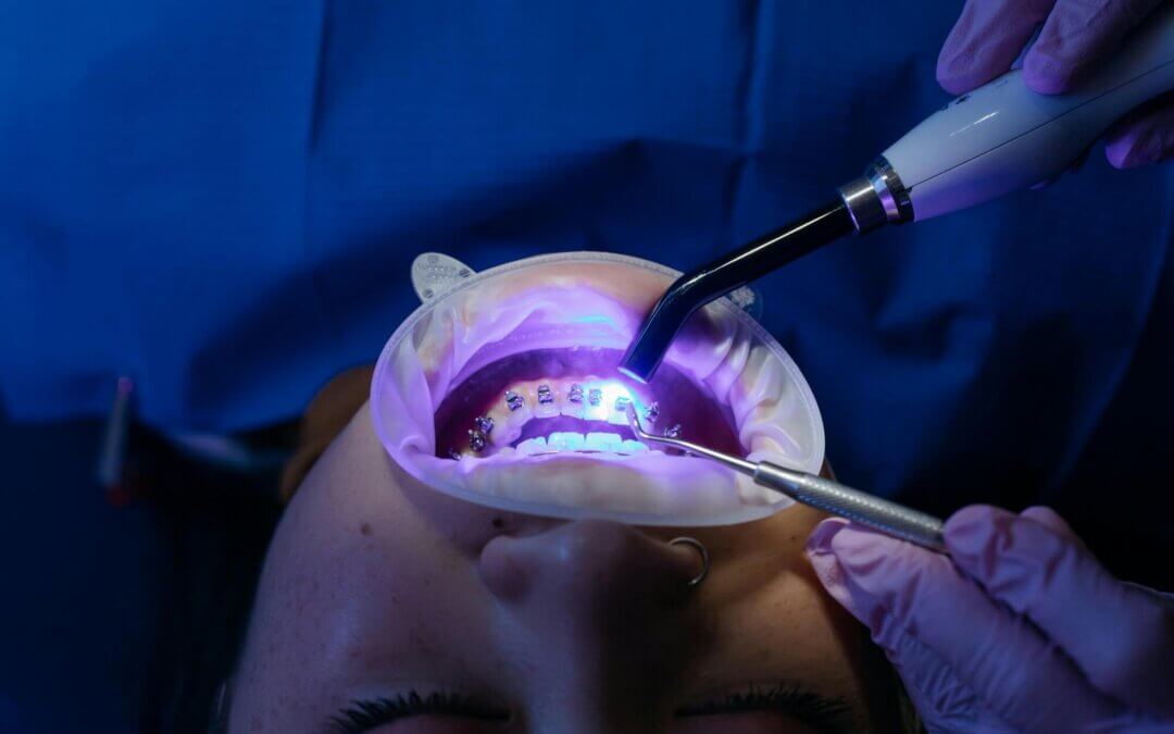 Orthodontist in Lakeway